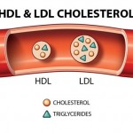 lipid máu