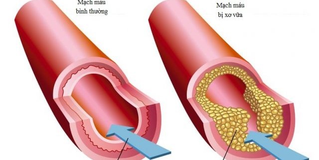 Bán Nhà Khương Trung thiết kế đẹp lô góc đường ô tô 2 làn 50m 4T giá 5.6 tỷ