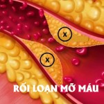 roi-loan-mo-mau-1